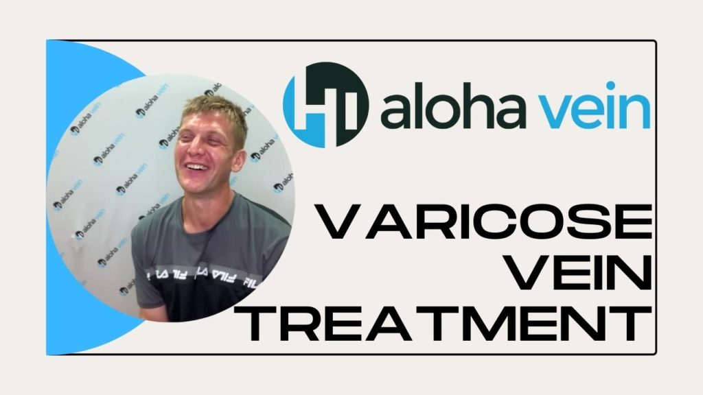 Varicose Vein Treatment Testimonial