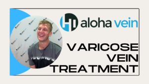Varicose Vein Treatment Testimonial
